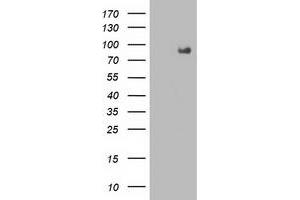 Western Blotting (WB) image for anti-Fibroblast Growth Factor Receptor 2 (FGFR2) antibody (ABIN1498249) (FGFR2 antibody)