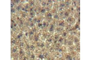 #VALUE! (C19ORF80 antibody  (AA 16-198))