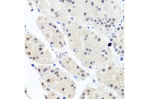 Immunohistochemistry of paraffin-embedded human stomach using HNRNPCL1 antibody (ABIN5995850) at dilution of 1/100 (40x lens). (HNRNPCL1 antibody)