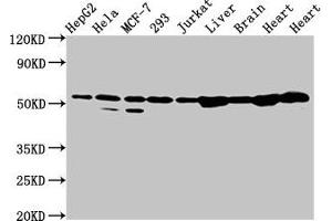 Western Blot Positive WB detected in: HepG2 whole cell lysate, Hela whole cell lysate, MCF-7 whole cell lysate, 293 whole cell lysate, Jurkat whole cell lysate, Rat liver tissue, Rat brain tissue, Rat heart tissue, Mouse heart tissue All lanes: DLD antibody at 2 μg/mL Secondary Goat polyclonal to rabbit IgG at 1/50000 dilution Predicted band size: 55, 44, 50 kDa Observed band size: 55 kDa (DLD antibody  (AA 398-495))