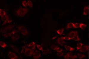 ABIN6274738 staining MCF7 by IF/ICC. (MRPL32 antibody  (Internal Region))