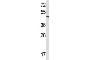 RNF41 antibody western blot analysis in 293 lysate. (RNF41 antibody  (AA 255-281))