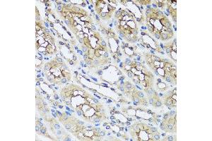 Immunohistochemistry of paraffin-embedded mouse kidney using AIP antibody at dilution of 1:100 (x40 lens). (AIP antibody)