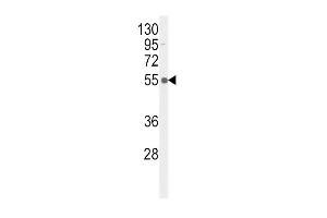 Western blot analysis of hTNFR-p (ABIN389672 and ABIN2839648) in MDA-M cell line lysates (35 μg/lane). (TNFRSF1A antibody  (pSer274))