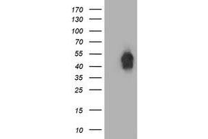 HEK293T cells were transfected with the pCMV6-ENTRY control (Left lane) or pCMV6-ENTRY BECN1 (Right lane) cDNA for 48 hrs and lysed. (Beclin 1 antibody)