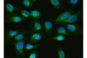 IF analysis of ARL13B using anti-ARL13B antibody (ABIN7600179). (ARL13B antibody  (AA 16-428))