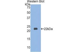 Detection of Recombinant MYL3, Human using Polyclonal Antibody to Myosin Light Chain 3, Alkali, Ventricular, Slow Skeletal (MYL3) (MYL3/CMLC1 antibody  (AA 5-181))