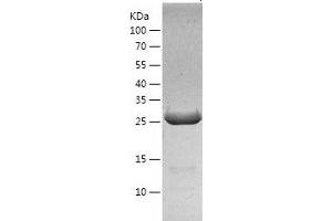 Western Blotting (WB) image for Dehydrogenase/reductase (SDR Family) Member 4 (DHRS4) (AA 1-278) protein (His tag) (ABIN7122623) (DHRS4 Protein (AA 1-278) (His tag))