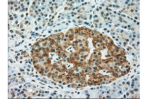 Immunohistochemical staining of paraffin-embedded Kidney tissue using anti-TYRO3mouse monoclonal antibody. (TYRO3 antibody)