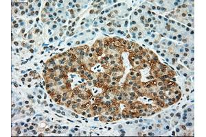Immunohistochemical staining of paraffin-embedded Kidney tissue using anti-TYRO3mouse monoclonal antibody.