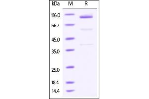 Mouse Glypican 3 / GPC3, Fc Tag on SDS-PAGE under reducing (R) condition.