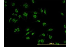 Immunofluorescence of monoclonal antibody to TRIM24 on HeLa cell. (TRIM24 antibody  (AA 432-569))