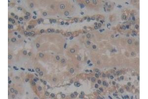 Immunohistochemistry (IHC) image for anti-Myosin, Heavy Polypeptide 10, Non-Muscle (MYH10) (AA 438-716) antibody (ABIN7435520)