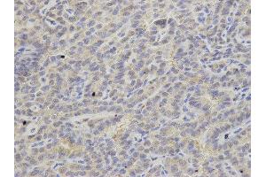 Immunohistochemistry (IHC) image for anti-Adenine Phosphoribosyltransferase (APRT) antibody (ABIN1876644) (APRT antibody)