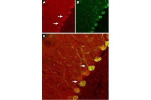 Expression of Nogo receptor in rat cerebellum - Immunohistochemical staining of rat cerebellum using Anti-Nogo Receptor (extracellular) Antibody (ABIN7043601, ABIN7044757 and ABIN7044758).