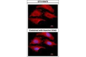 Image no. 3 for anti-G1 To S Phase Transition 1 (GSPT1) (AA 1-637) antibody (ABIN1498536) (GSPT1 antibody  (AA 1-637))