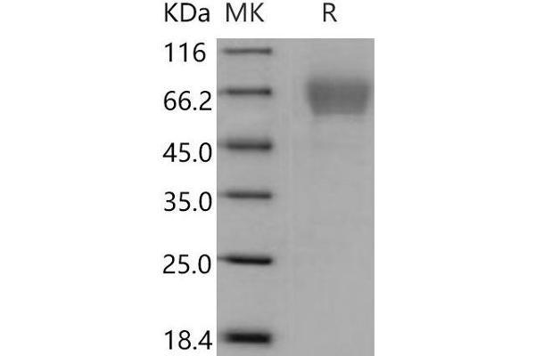 TIMD4 Protein (His tag)