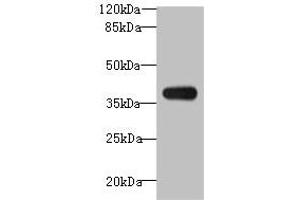 Western blot All lanes: ASB7 antibody at 8 μg/mL + A431 whole cell lysate Secondary Goat polyclonal to rabbit IgG at 1/10000 dilution Predicted band size: 37, 31 kDa Observed band size: 37 kDa (ASB7 antibody  (AA 1-274))