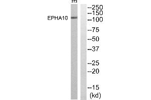 Western blot analysis of extracts from NIH-3T3 cells, using EPHA10 antibody. (EPH Receptor A10 antibody  (Internal Region))