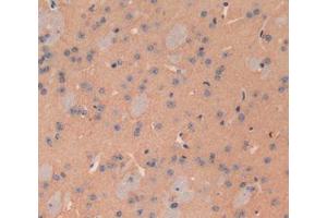 Used in DAB staining on fromalin fixed paraffin- embedded brain tissue (ATP2B2 antibody  (AA 417-830))