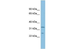 WB Suggested Anti-MSRA Antibody Titration: 0. (MSRA antibody  (Middle Region))