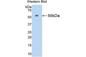 Western Blotting (WB) image for anti-Angiotensinogen (serpin Peptidase Inhibitor, Clade A, Member 8) (AGT) (AA 25-477) antibody (ABIN1173620) (AGT antibody  (AA 25-477))