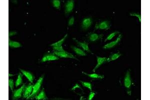 Immunofluorescent analysis of Hela cells using ABIN7152425 at dilution of 1:100 and Alexa Fluor 488-congugated AffiniPure Goat Anti-Rabbit IgG(H+L) (F-Box Protein 3 antibody  (AA 276-376))