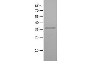 Western Blotting (WB) image for Rab9 Effector Protein with Kelch Motifs (RABEPK) (AA 120-367) protein (His tag) (ABIN7283324) (RABEPK Protein (AA 120-367) (His tag))