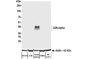 Western Blotting (WB) image for anti-CD8a Molecule (CD8A) (AA 28-194) antibody (ABIN7453877) (Recombinant CD8 alpha antibody  (AA 28-194))