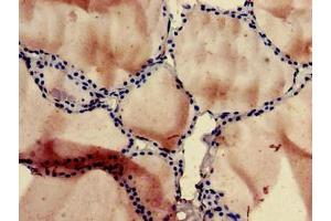 Immunohistochemistry of paraffin-embedded human thyroid tissue using ABIN7162462 at dilution of 1:100 (SLC1A3 antibody  (AA 7-151))