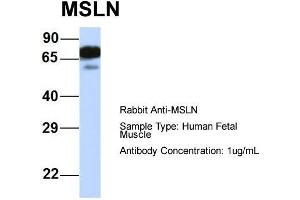 Host:  Rabbit  Target Name:  MSLN  Sample Type:  Human Fetal Muscle  Antibody Dilution:  1. (Mesothelin antibody  (Middle Region))