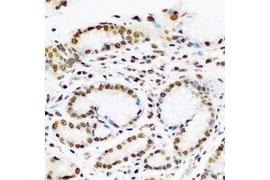Immunohistochemical analysis of PC4 staining in human stomach formalin fixed paraffin embedded tissue section. (SUB1 antibody)