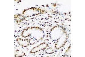 Immunohistochemical analysis of PC4 staining in human stomach formalin fixed paraffin embedded tissue section.