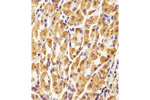 Immunohistochemical analysis of paraffin-embedded H. (GAPDH antibody)