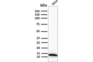 Western Blot Analysis of human HeLa cell lysate using S100A4 Recombinant Rabbit Monoclonal Antibody (S100A4/2750R). (Recombinant s100a4 antibody  (AA 1-200))