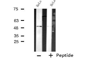 Western blot analysis of extracts from HeLa cells using CDC20 antibody. (CDC20 antibody  (N-Term))