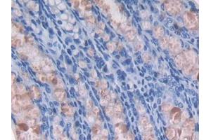 DAB staining on IHC-P; Samples: Mouse Colon Tissue (GMFG antibody  (AA 12-127))