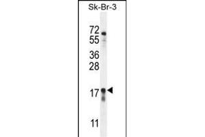 C Antibody (Center) (ABIN655473 and ABIN2844997) western blot analysis in SK-BR-3 cell line lysates (35 μg/lane). (C1ORF115 antibody  (AA 76-104))