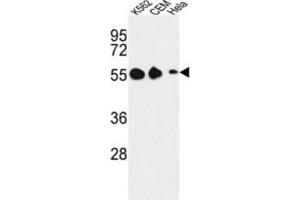 Western Blotting (WB) image for anti-Galanin Receptor 1 (GALR1) antibody (ABIN3004139) (Galanin Receptor 1 antibody)