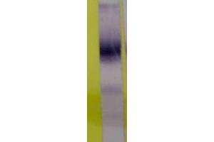 Western Blotting (WB) image for anti-Lipopolysaccharide Binding Protein (LBP) antibody (ABIN343175) (LBP antibody)