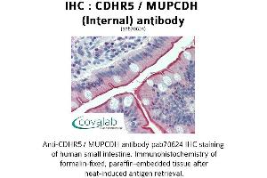 Image no. 1 for anti-Mucin and Cadherin-Like (CDHR5) (Internal Region) antibody (ABIN1732924) (CDHR5 antibody  (Internal Region))