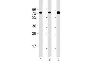 Western blot testing of human 1) Jurkat, 2) Ramos and 3) HT-1080 cell lysate with GARS antibody at 1:2000. (GARS antibody  (AA 15-305))