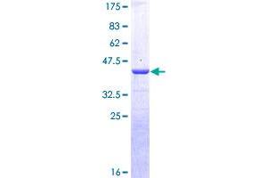 Image no. 1 for Calcitonin-Related Polypeptide alpha (CALCA) (AA 1-141) protein (GST tag) (ABIN1347865)