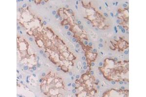 Used in DAB staining on fromalin fixed paraffin- embedded kidney tissue (ABCB7 antibody  (AA 472-752))