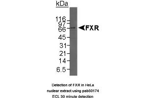 Image no. 1 for anti-Nuclear Receptor Subfamily 1, Group H, Member 4 (NR1H4) (C-Term) antibody (ABIN363483) (NR1H4 antibody  (C-Term))