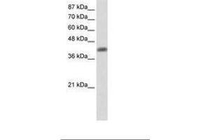 Image no. 2 for anti-Aprataxin (APTX) (C-Term) antibody (ABIN203063) (Aprataxin antibody  (C-Term))
