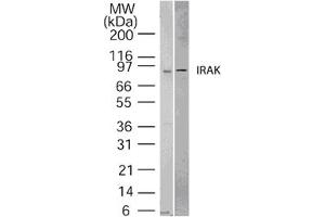 Image no. 1 for anti-Interleukin-1 Receptor-Associated Kinase 1 (IRAK1) (AA 700-712) antibody (ABIN208558) (IRAK1 antibody  (AA 700-712))
