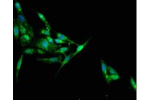 Immunofluorescence staining of Hela cells with ABIN7157178 at 1:100, counter-stained with DAPI. (Junctophilin 1 antibody  (AA 431-546))