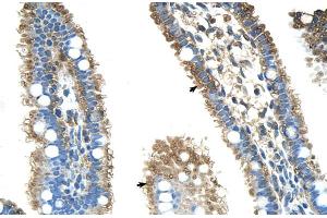 Human Intestine (ALDH4A1 antibody  (N-Term))
