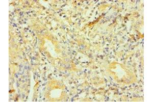 Immunohistochemistry of paraffin-embedded human kidney tissue using ABIN7150804 at dilution of 1:100 (Dynactin 1 antibody  (AA 1084-1278))